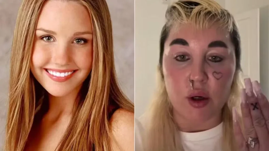 Where is Amanda Bynes Now